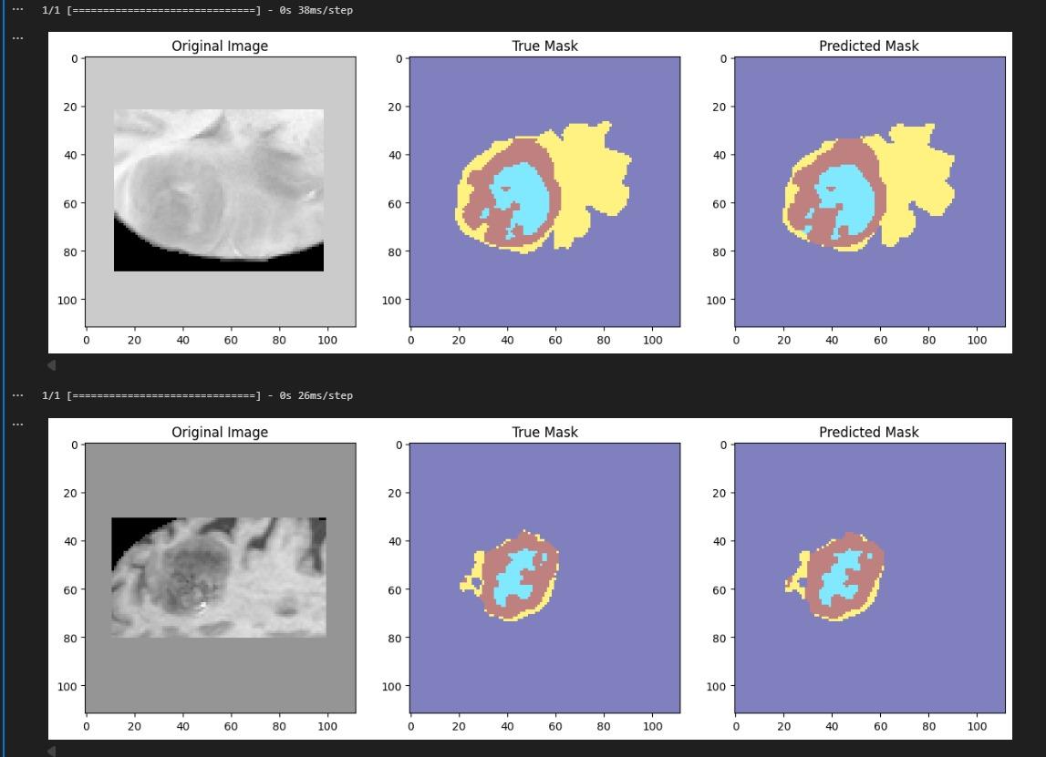 3D Brain_Tumor_Segmentation